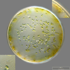 Coscinodiscus wailesii
