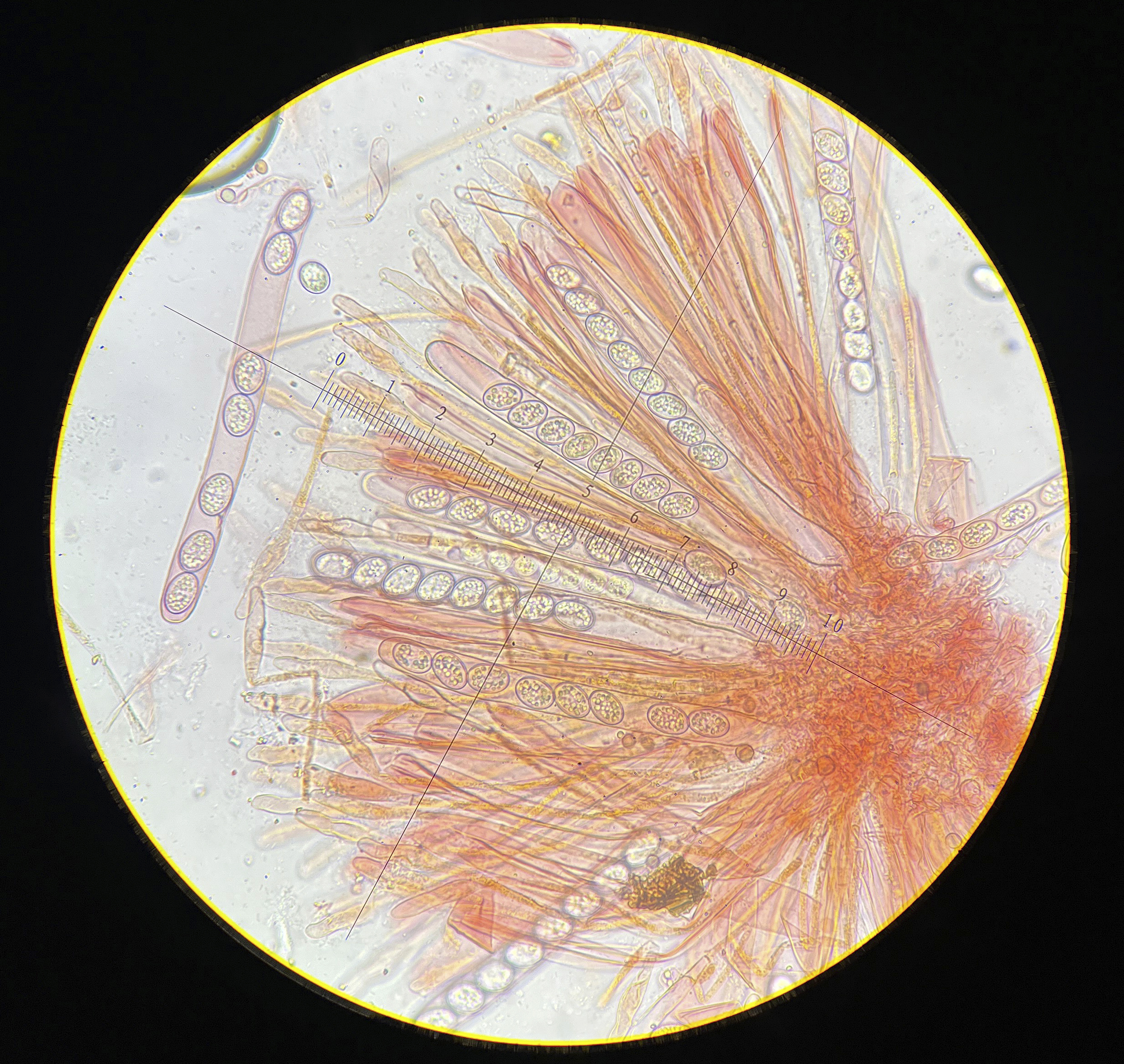 Scutellinia sp.