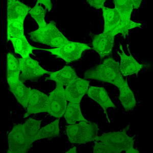 Cancer Cells - Foto: Mina Petrovic