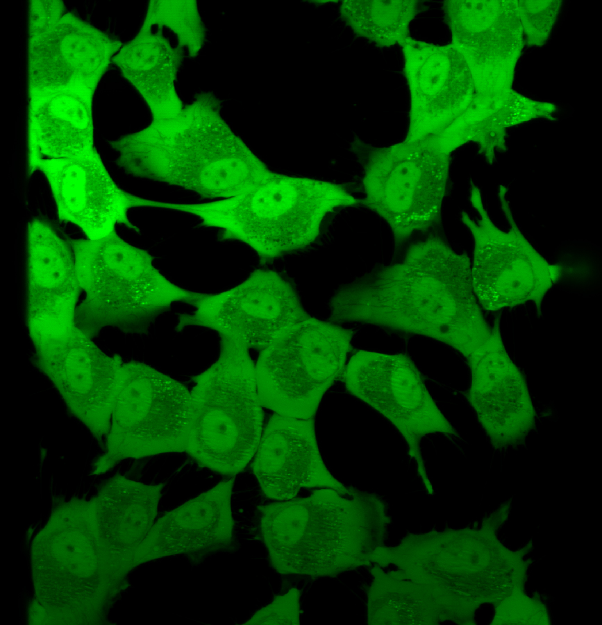 Cancer Cells - Foto: Mina Petrovic