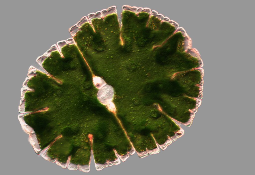 Micrasterias denticulata