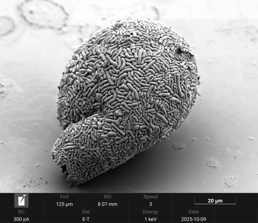 Schalenamöbe Lesquerusia spiralis Schalenamöben Testacea Testaceen Thecamöben