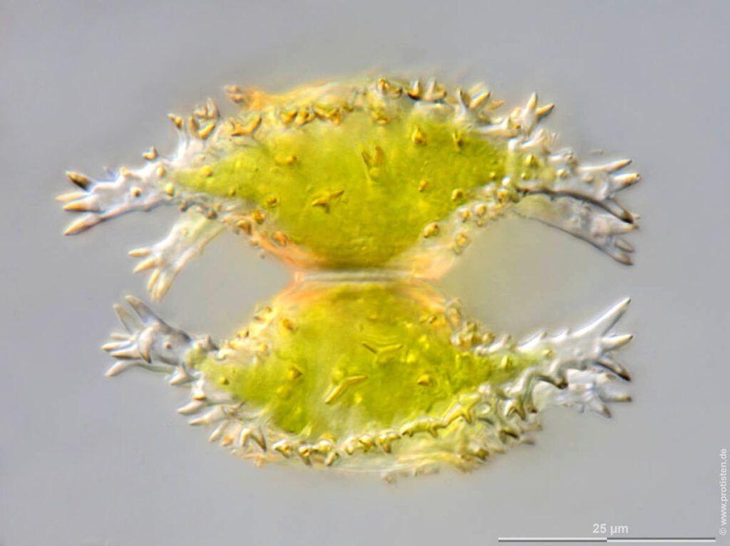 Zieralge Staurastrum vestitum var. vestitum Zieralgen, Desmidiaceen, Streptophyta